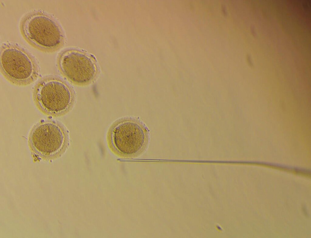 Microscope View Of Eggs Fertility With Needle
