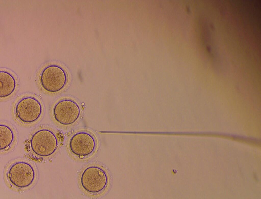 Microscope View of Eggs Fertility