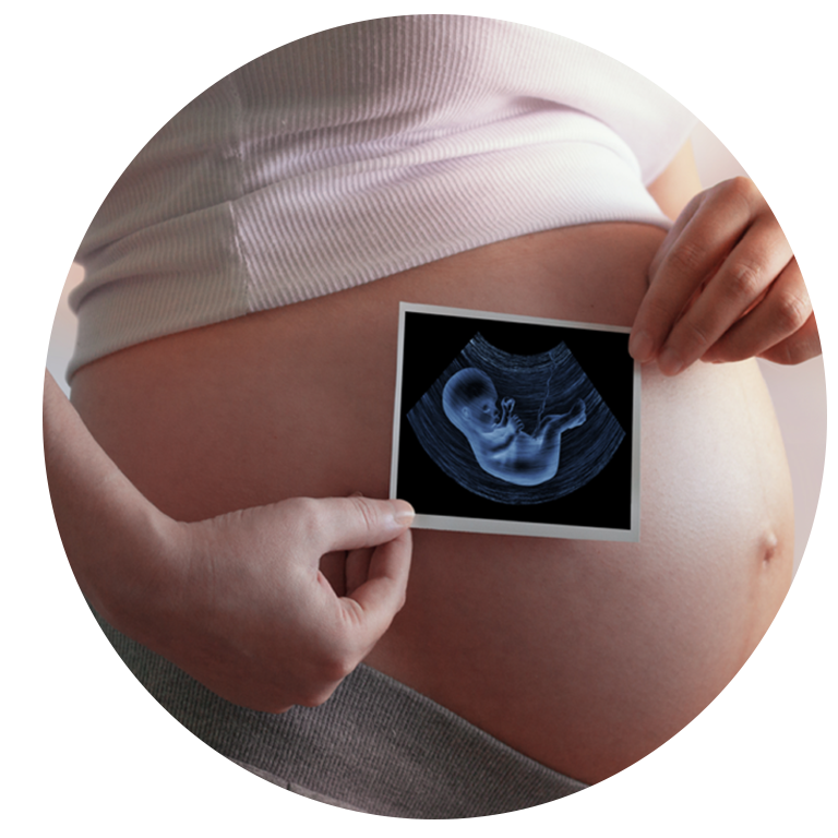 Pregnant Woman Holding Ultrasound Scan